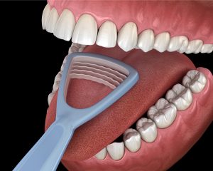 LCIAD Hygiene Tongue Cleaner 1